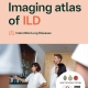 Poster-Book-ILD